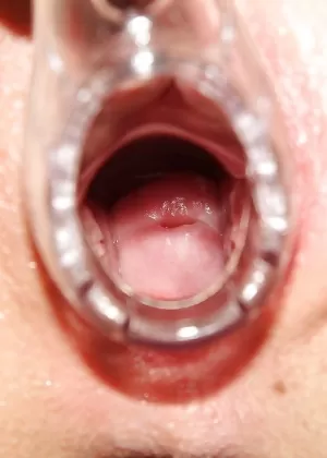 Горячие медсестры участвуют в обратной групповухе с пациентом-мужчиной