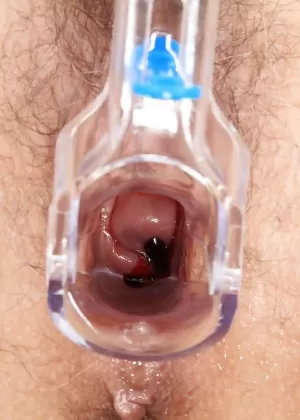 Пышногрудую зрелую мегеру в чулках осматривает удачливый гинеколог